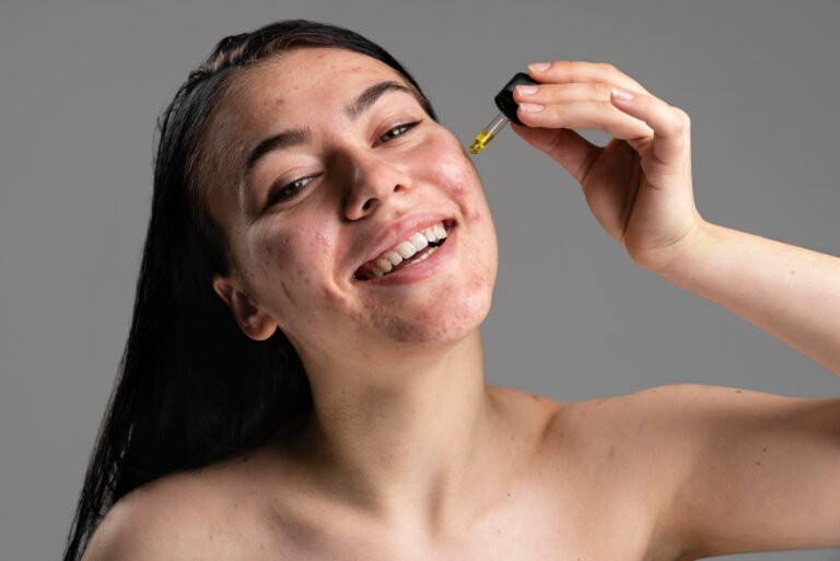 Best Toner for Acne