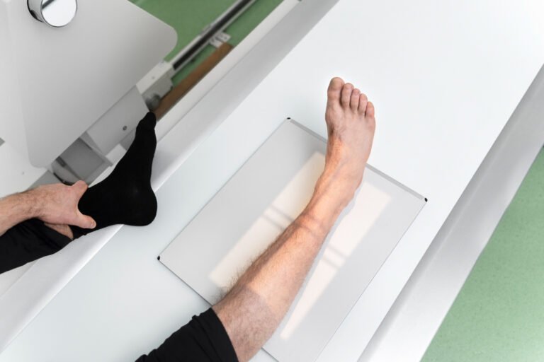precice nail surgery gurgaon